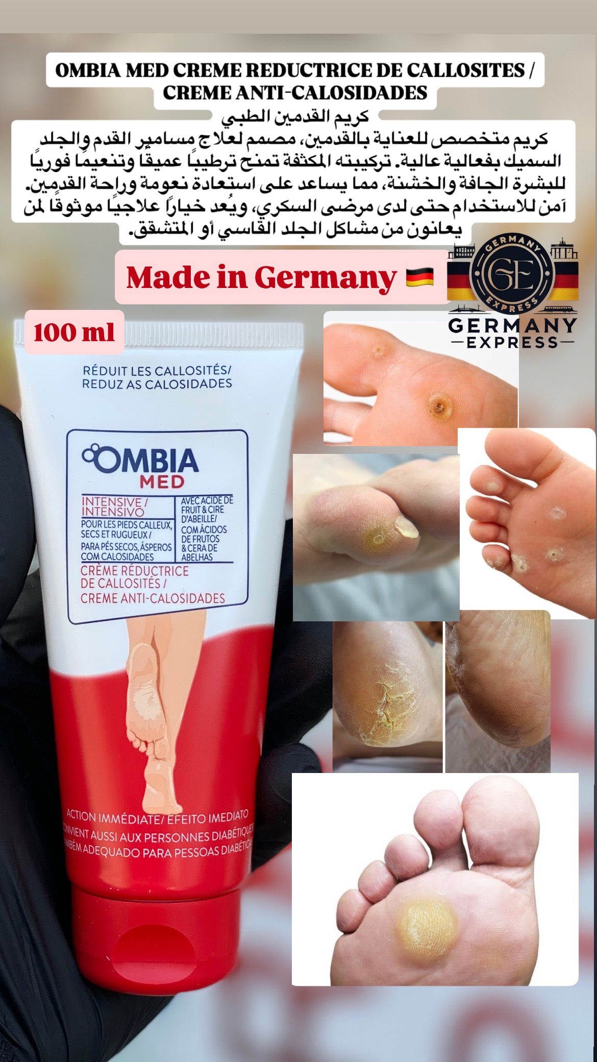 Ombia Med Foot Cream – Anti Calluses & Corns.