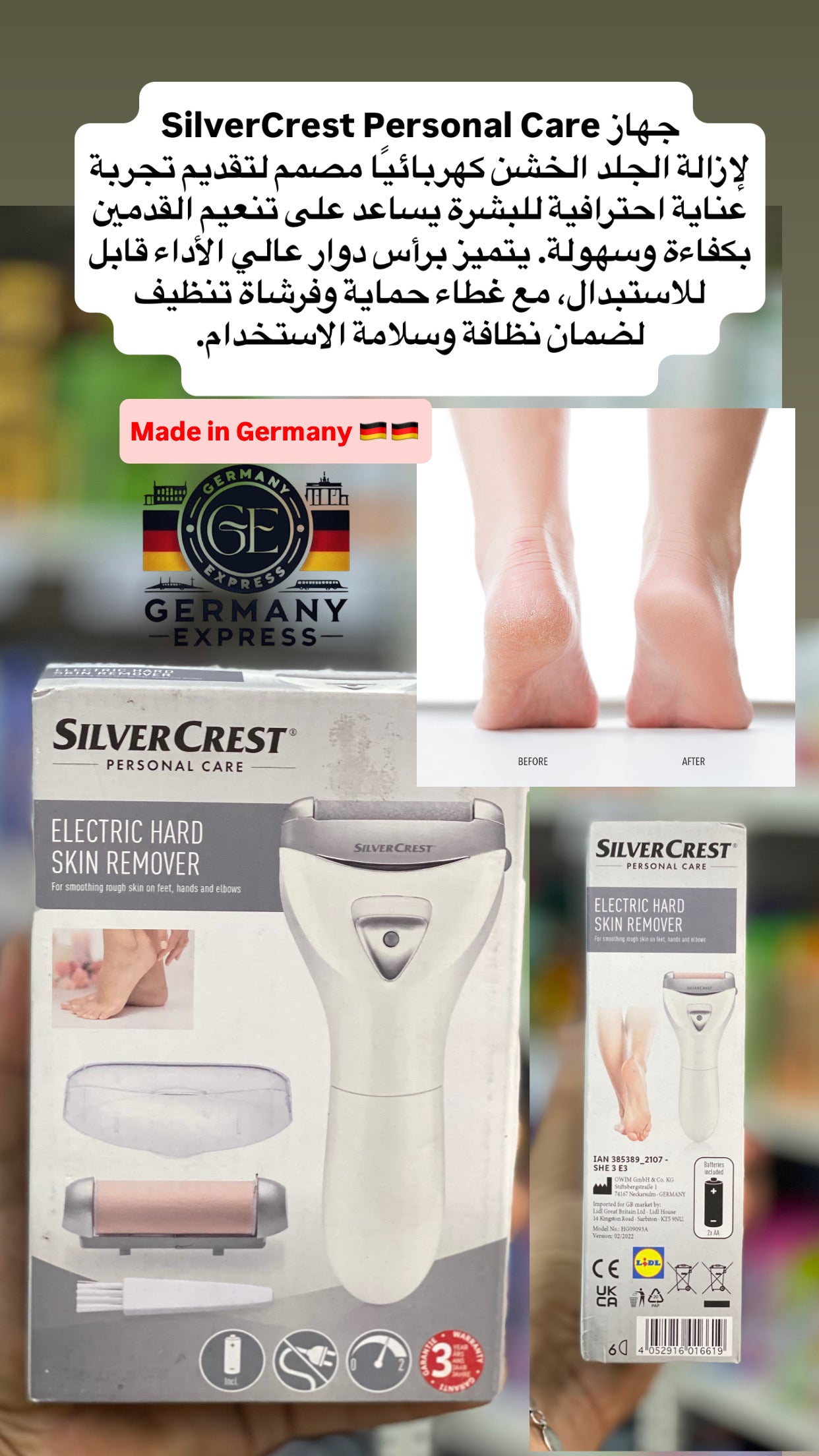 SILVER CREST PERSONAL CARE ELECTRIC HARD SKIN REMOVER For smoothing rough skin on feet, hands and elbows.