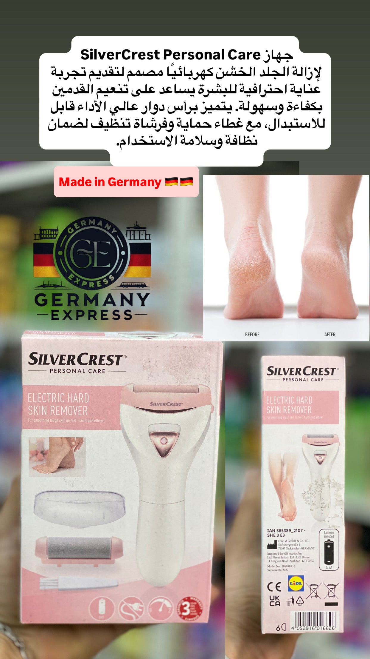 SILVER CREST PERSONAL CARE ELECTRIC HARD SKIN REMOVER For smoothing rough skin on feet, hands and elbows.